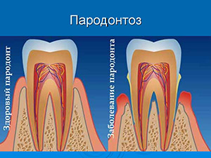 зубосохраняющие процедуры