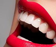 Отбеливание зубов при помощи системы Luma Cool