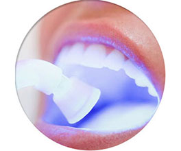 Отбеливание зубов Luma Cool Томск Добрый дентли стоматология
